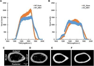 The myosin and RhoGAP MYO9B influences osteocyte dendrite growth and responses to mechanical stimuli